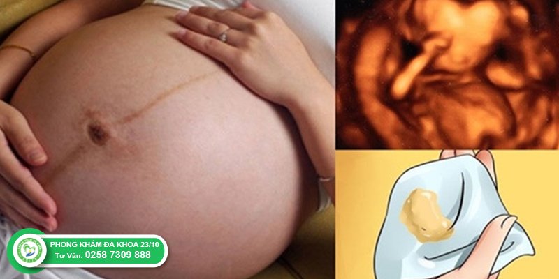 VIÊM NHIỄM PHỤ KHOA TRONG THAI KỲ, NHỮNG ĐIỀU CẦN BIẾT